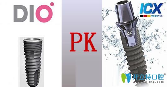 韓國dio和德國icx種植體綜合比較