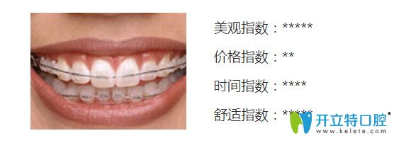 使用康貝佳口腔陶瓷半隱形托槽矯正優(yōu)惠