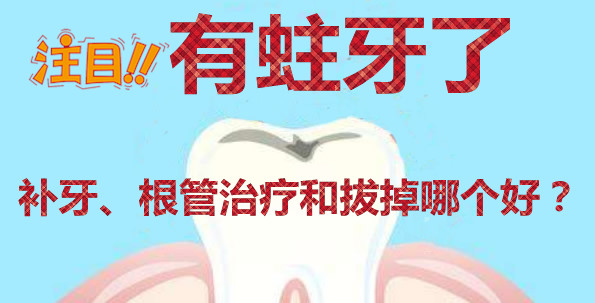蛀牙怎么辦 補(bǔ)牙根管治療和直接拔掉哪個(gè)好 得看齲壞程度