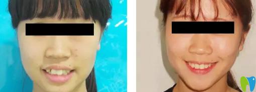 美樂口腔正畸<span style=