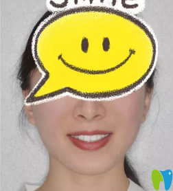 美樂口腔金屬托槽矯正牙齒18個(gè)月<span style=