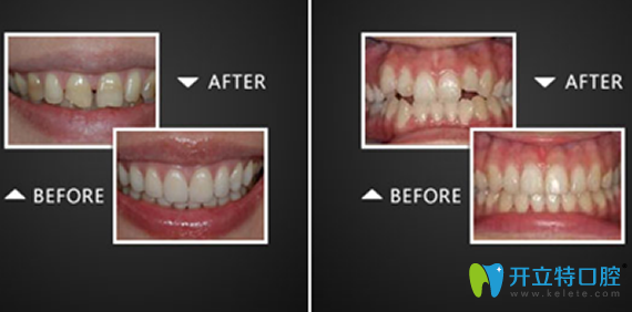 淮安口腔哪家好？看完牙知道口腔牙齒美容案例就知道