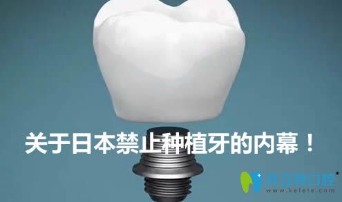 內(nèi)幕！日本為什么停止種植牙？禁止種植牙是真的嗎？