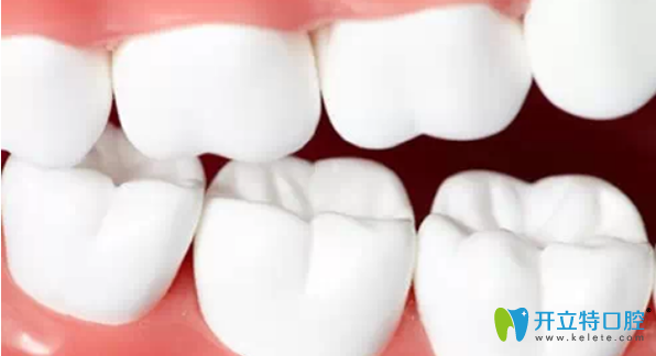 牙齒咬合力過大也容易引起牙齒松動