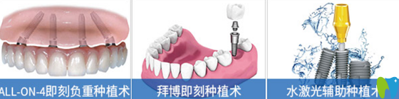 屬于拜博口腔的數(shù)字化種植牙技術(shù)