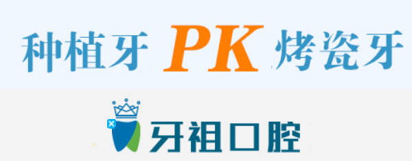 烤瓷牙和種植牙哪個(gè)好 長沙牙祖口腔詳述兩者的區(qū)別+優(yōu)劣勢