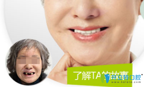 無錫北極星口腔多顆牙缺失種植案例