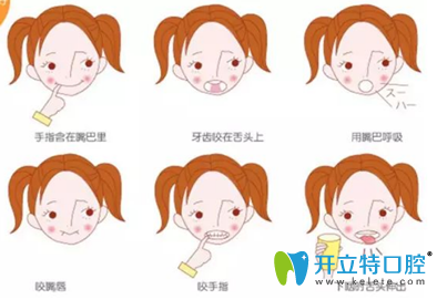 怎么判斷孩子是否需要MRC訓(xùn)練治療