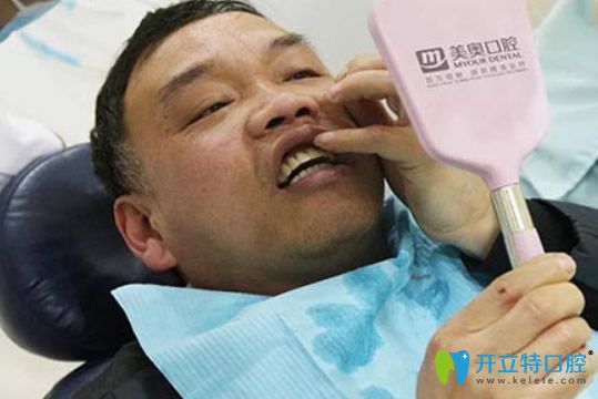 穿顴種植牙槽骨嚴(yán)重萎縮患者迎來曙光