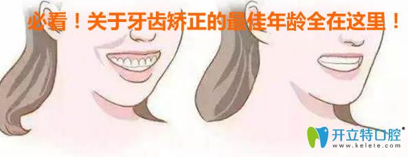 內(nèi)幕！如果錯(cuò)過了牙齒矯正的較佳年齡，會讓你后悔一輩子
