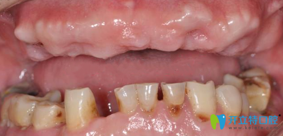 南京金臺口腔手術(shù)前 南京金臺口腔手術(shù)前