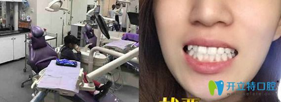 潔牙后顧客評價北京今生口腔