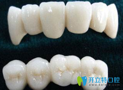 牙隱裂一定要做烤瓷牙修復(fù)嗎