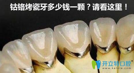 鈷鉻合金烤瓷牙多少錢一顆?看了價格表就知道500元貴不貴了