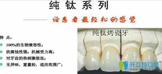 m.ardc-srvc.com純鈦烤瓷牙圖片