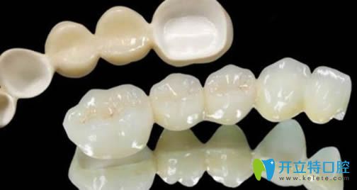 蘇文泰解析活動(dòng)假牙的種類及價(jià)格 蘇文泰解析活動(dòng)假牙的種類及價(jià)格