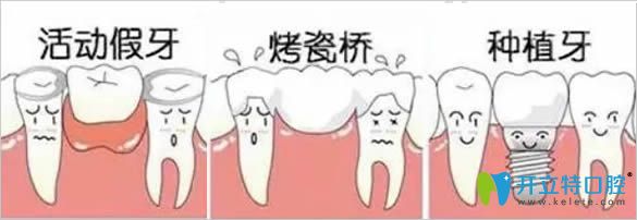 青島天皓口腔門診牙齒修復方式圖