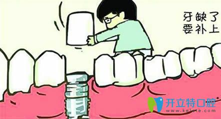 牙齦萎縮還能種植牙嗎?重慶皇仕口腔舒斯特院長給出詳解
