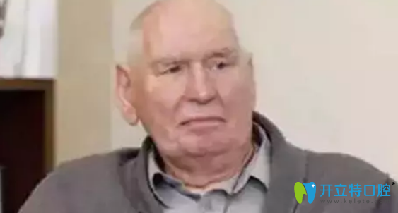 種植牙使用時間較長的42歲的瑞典人Sven Johansson