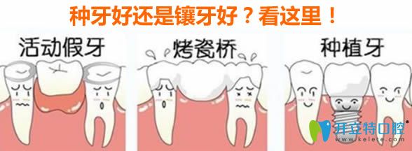 福州馬瀧齒科鄭瑜謙科普種牙好還是鑲牙好