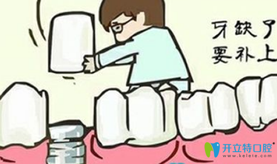 拔牙后多久可以鑲牙？拔牙后鑲牙有沒有時間？