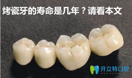 烤瓷牙的壽命是幾年?上海圣貝的王申來(lái)揭秘烤瓷牙使用年限