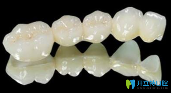 補(bǔ)一顆烤瓷牙多少錢？鑲的烤瓷使用10年正常嗎？