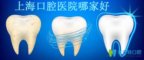 美奧口腔怎么樣 內(nèi)附牙齒矯正四大技術及收費價格