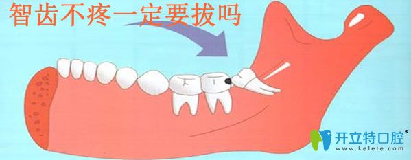 全面了解拔智齒的危害并分享智齒不疼一定要拔嗎？