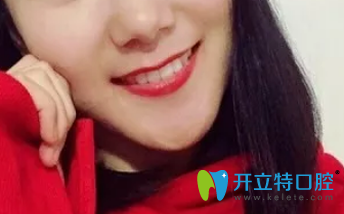 <!--<i data=20240703-sp></i>-->口腔剛摘戴牙套時(shí)候圖片