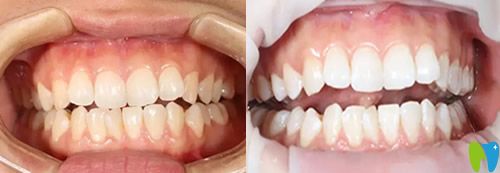 重慶牙科哪里好？看完美維口腔真人案例+價格表你還不心動