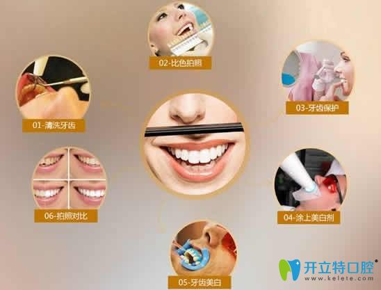  牙黑牙黃做牙齒冷光美白多少錢?國內(nèi)全新價(jià)格及注意事項(xiàng)