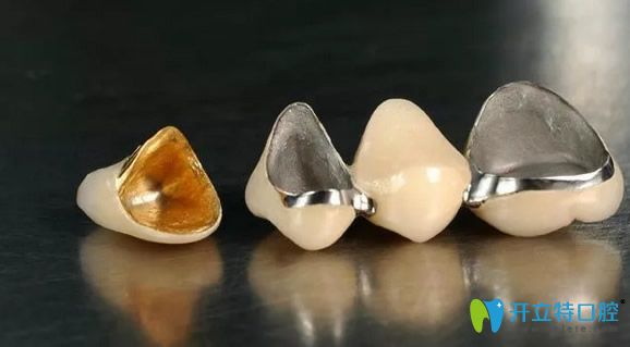 烤瓷牙和全瓷牙是美白牙齒的有效方式