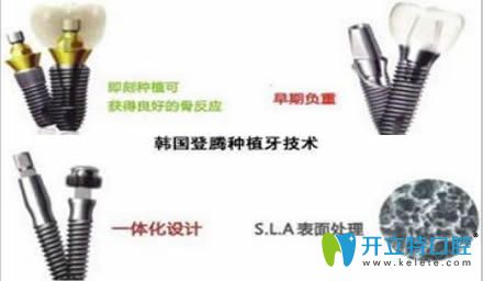 登騰種植牙為什么便宜?解析韓國登騰種植體的價格和壽命
