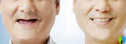 金禮彬醫(yī)生科普60歲老人能做種植牙好不好