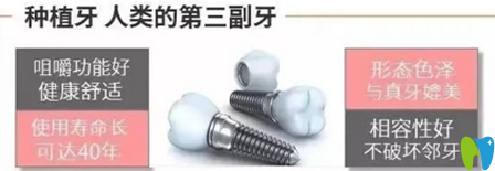種植牙優(yōu)勢(shì)有哪些