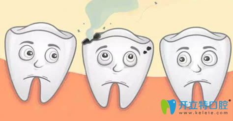 西安海濤口腔趙文雅醫(yī)生解析兒童齲病的預(yù)防方法