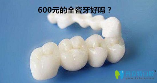 600元的全瓷牙好嗎？全瓷牙套1000一顆貴嗎