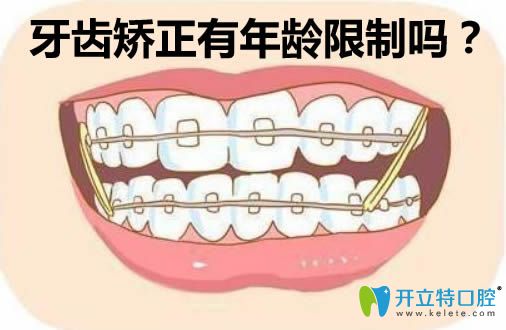 李解析牙齒矯正有年齡限制嗎