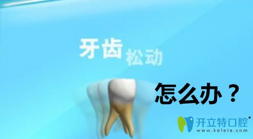 牙齒松動(dòng)怎么治療？做修復(fù)的話價(jià)格大概需要多少錢？