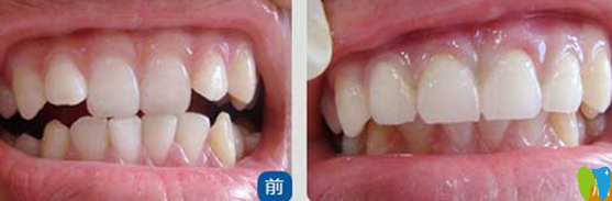 天津美萊口腔高志永怎么樣？真人案例及反饋來嘍