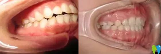 長(zhǎng)沙科爾雅口腔怎么樣，好不好？來(lái)看顧客看牙后反饋及評(píng)價(jià)