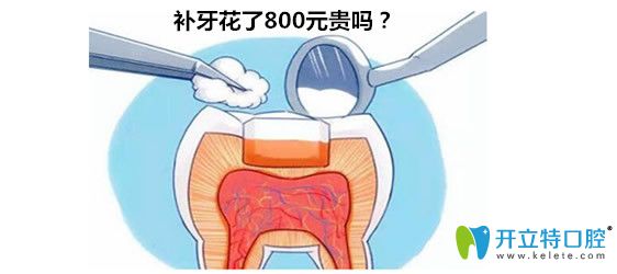 杭州口腔醫(yī)院補牙800元貴不貴?求2024杭州口腔醫(yī)院補牙價格表