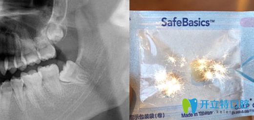 <!--<i data=20240703-sp></i>-->口腔朝陽(yáng)北路拔智齒