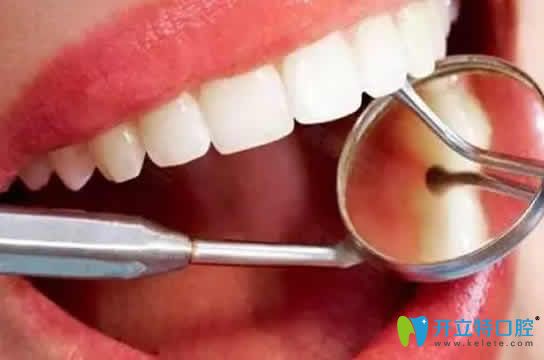 洗牙對(duì)牙齒好嗎？這里告訴你洗牙對(duì)牙齒有沒(méi)有傷害