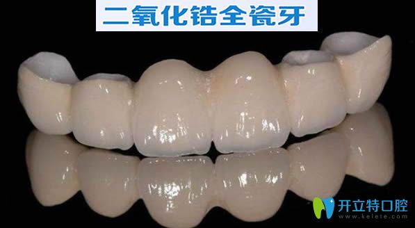 公布二氧化鋯全瓷牙價(jià)格表 看完就知道全瓷牙套多少錢一顆