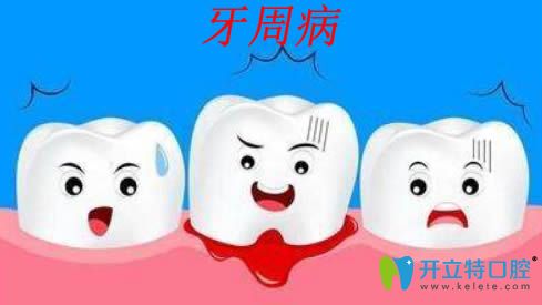 牙周病是什么？治療牙周病的方法和臨床效果分析