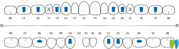 寧波壹加壹口腔牙齒矯正方案圖