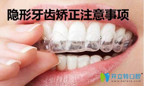 武漢壹加壹口腔周寧科普隱形牙齒矯正注意事項(xiàng) 武漢壹加壹口腔周寧科普隱形牙齒矯正注意事項(xiàng)