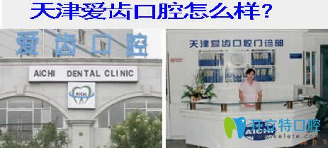 點(diǎn)擊看天津愛齒口腔價(jià)格表和牙齒矯正/種植牙真人案例效果